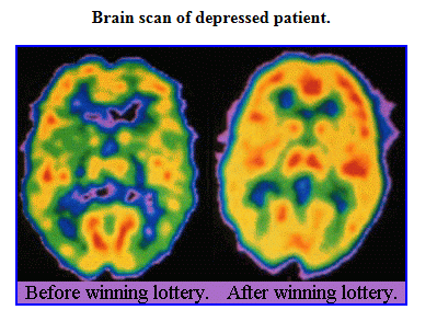 bonkers brain - cash